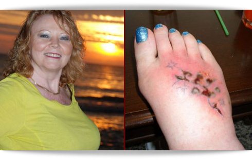 Uma mulher fez uma tatuagem e quase perdeu o pé