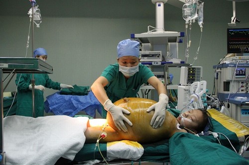 Garota de 12 anos é submetida a cirurgia para retirar tumor de 15kg