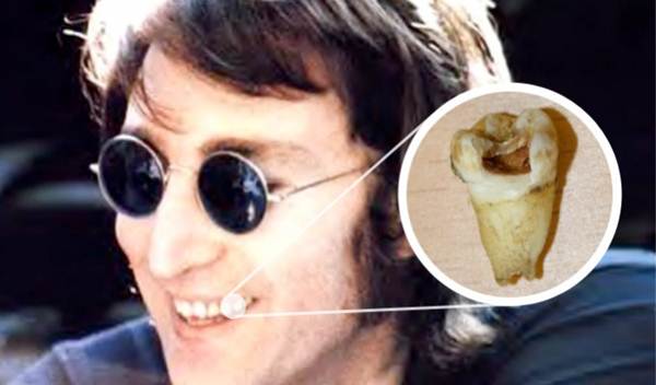Canadense compra dente de John Lennon e pretende clonar o famoso Beatle