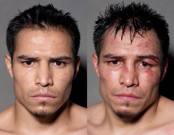 12 fotos de boxeadores antes e depois da luta