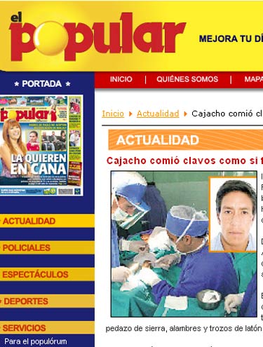 Médicos retiram 1 quilo de pregos do estômago de um Peruano