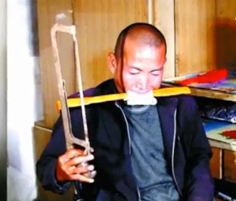 Chinês que estava sem dinheiro para operação amputa sozinho sua perna direita