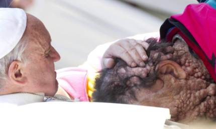 Homem bolha recebe benção de Papa Francisco