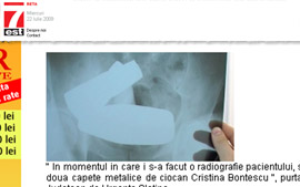 Homem vai parar no hospital com dois martelos entalados no intestino