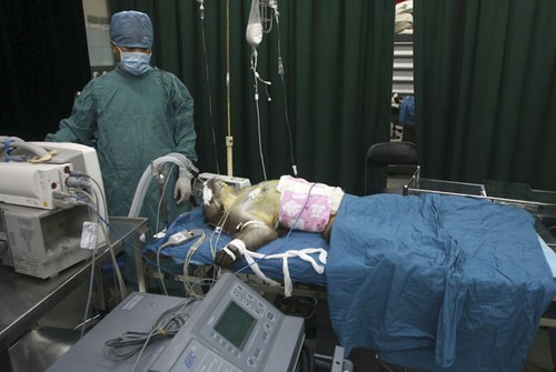 Transplante inusitado na China: Macaco recebe fígado de porco