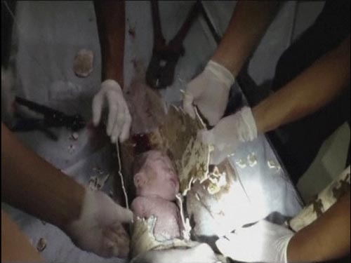Revoltante: Bebê é resgatado depois de ser jogado em cano de esgoto