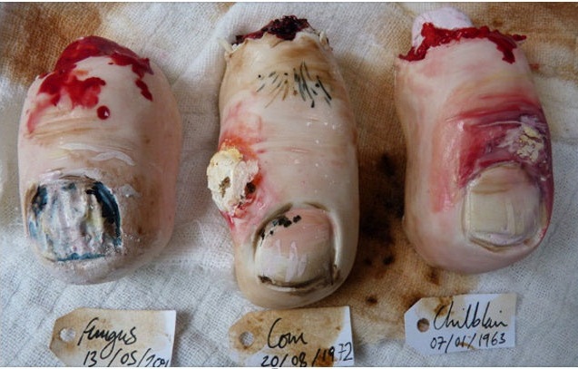 Saboroso e repugnante: Bolinhos zumbis