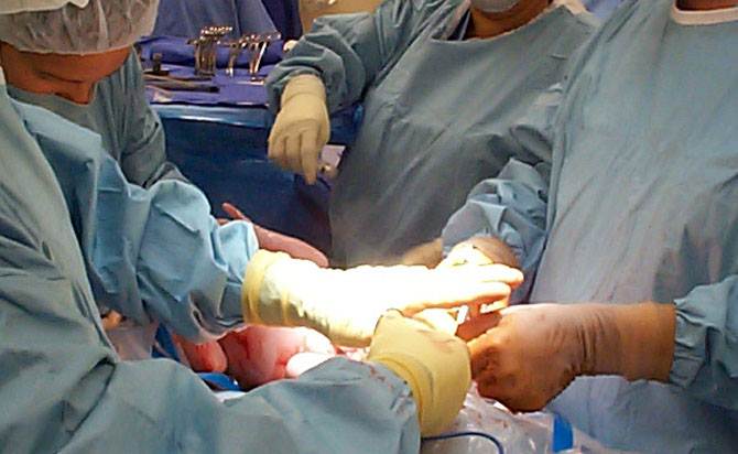 Americana “ressuscita” na mesa de operação para retirada de seus órgãos
